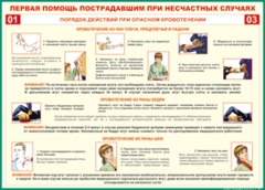 Таблица "Порядок действий при опасном кровотечении" (100х140 сантиметров, винил) - fgospostavki.ru - Новочеркасск